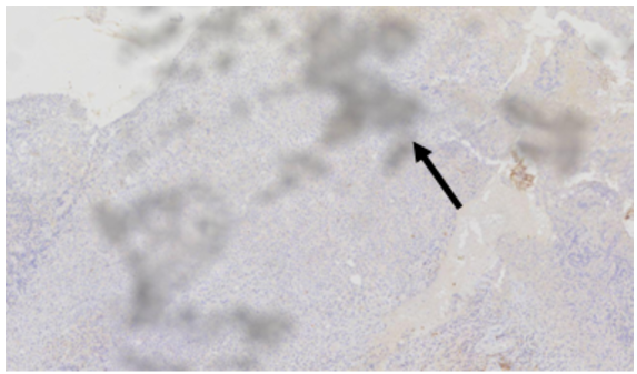 A black arrow pointing to a white surface AI-generated content may be
incorrect.