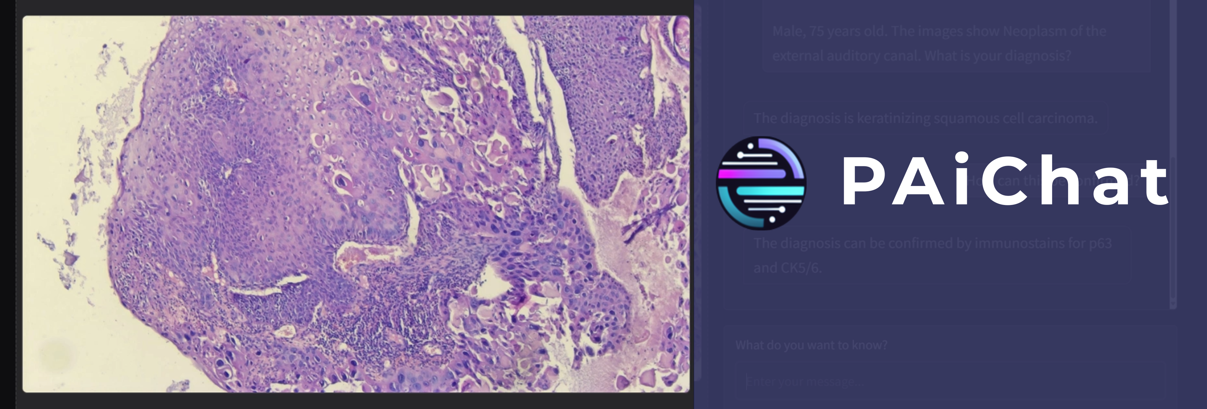 Introducing PAiChat: Enhancing Pathologists’ Workflow with AI-Driven Multimodal Support