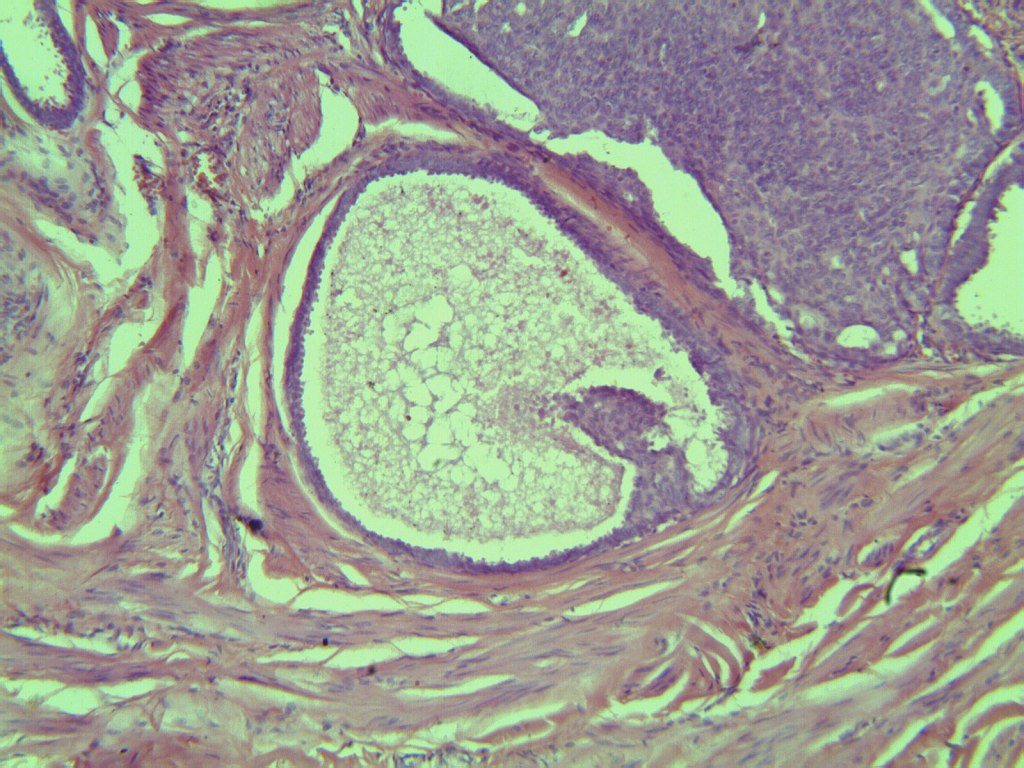 H&E Breast Slide