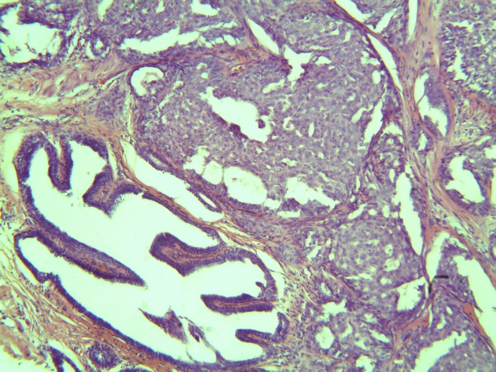 H&E Breast Slide