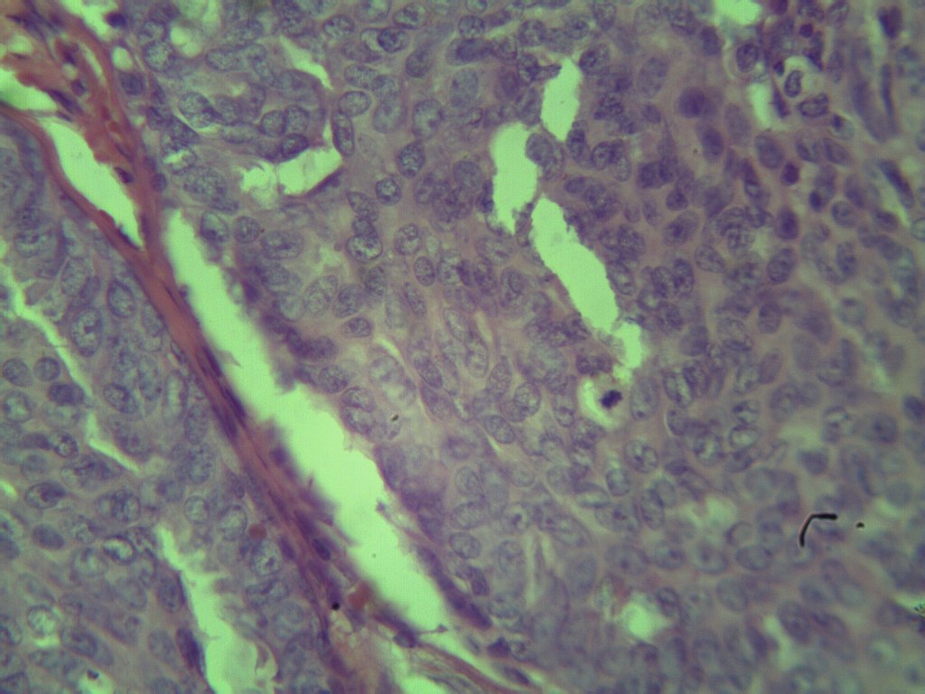 H&E Breast Slide