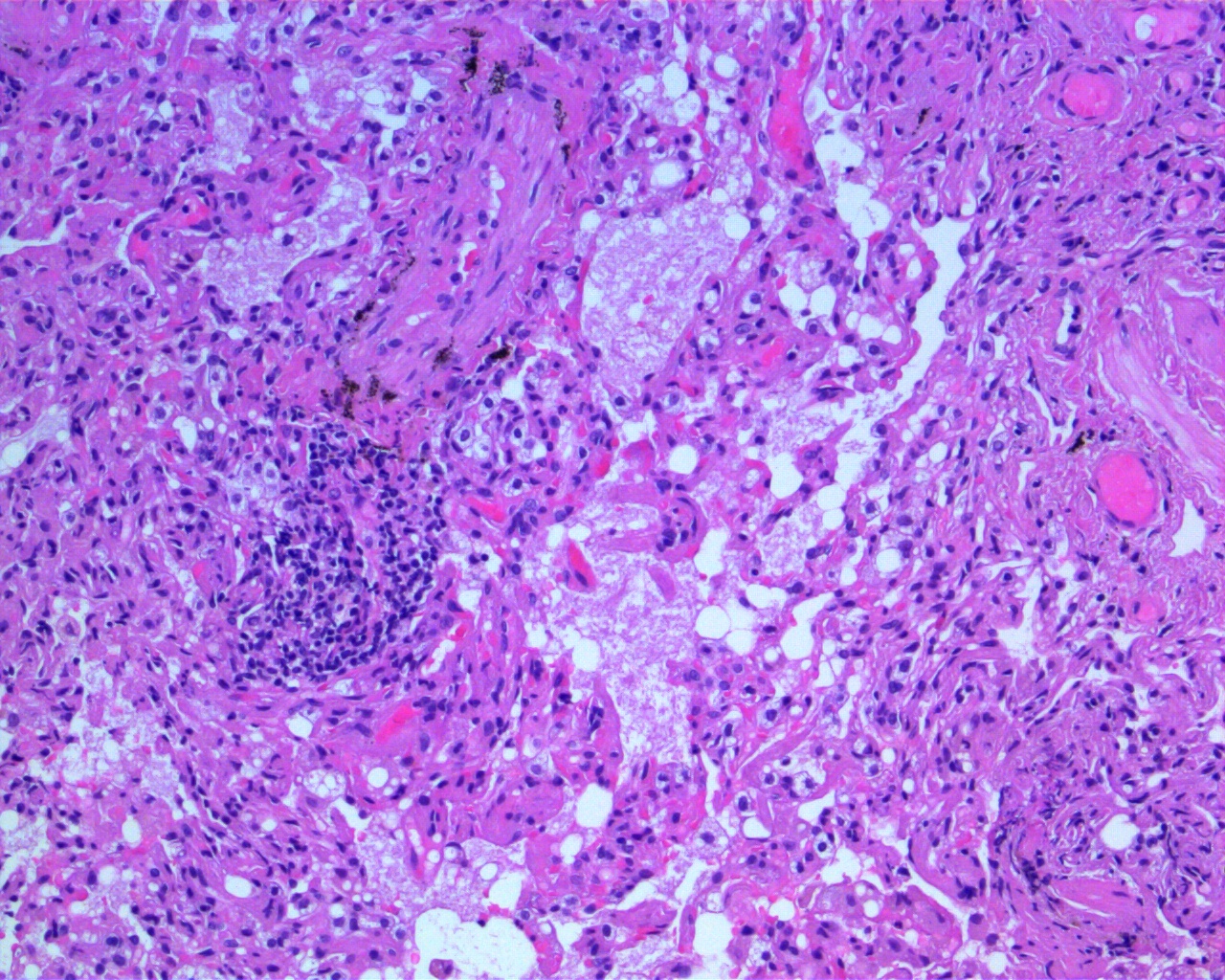 H&E Lung Slide