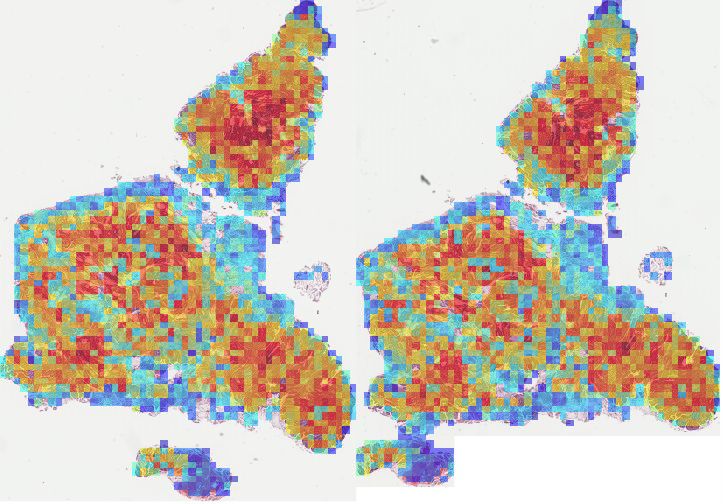 Attention heatmap